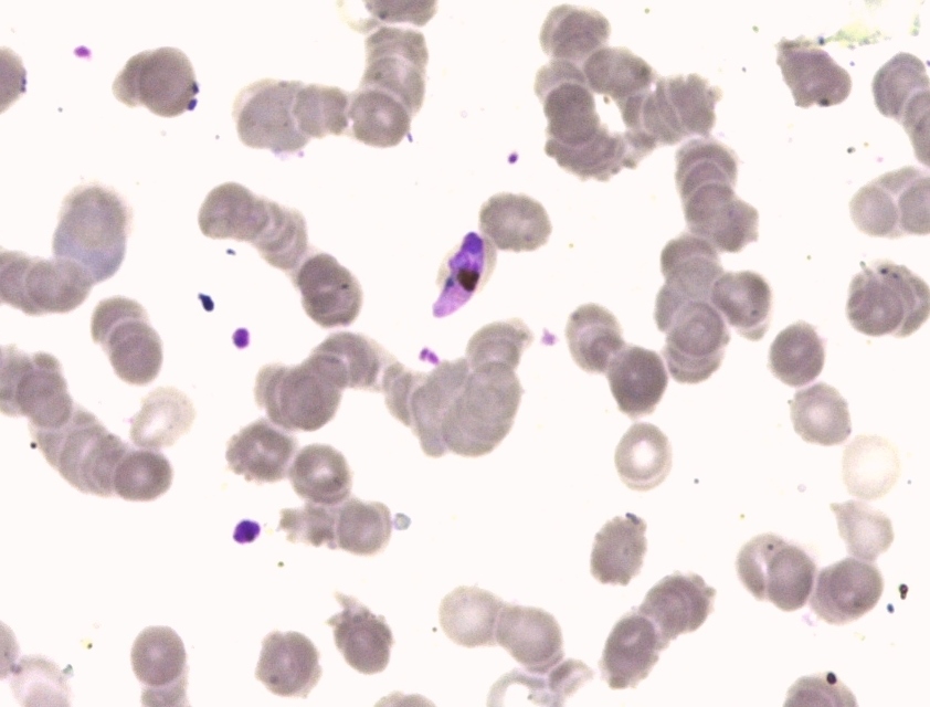 Banana gametocyte